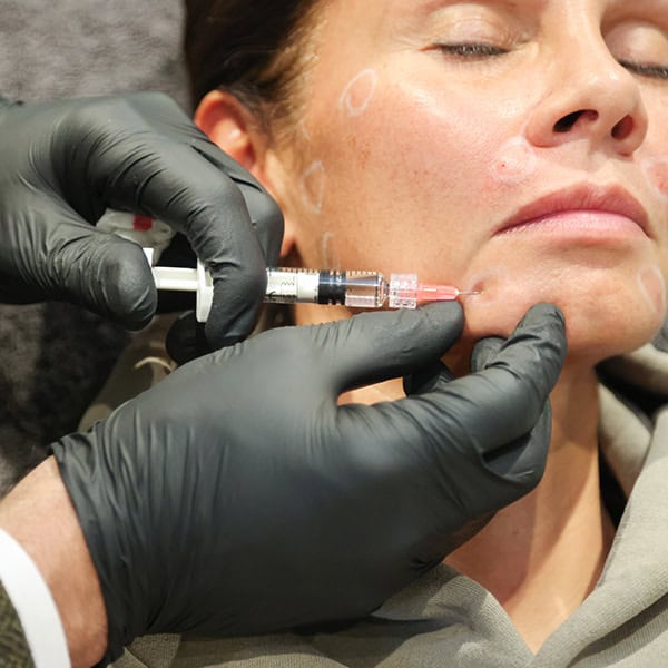 Woman receiving skin rejuvenation injection at Cannelle Skin Clinic, professional skincare treatment.