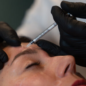 botox-forehead
