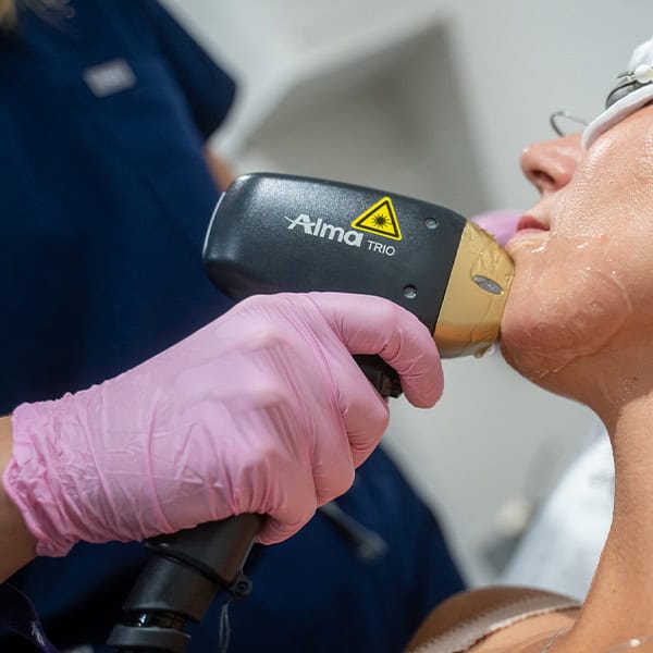 Laser skin rejuvenation treatment being performed at Cannelle Skin Clinic.