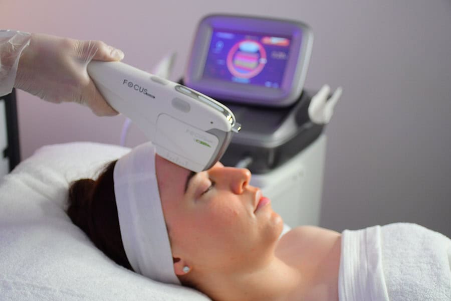 Woman receiving skin rejuvenation treatment with advanced device at Cannelle Skin Clinic.