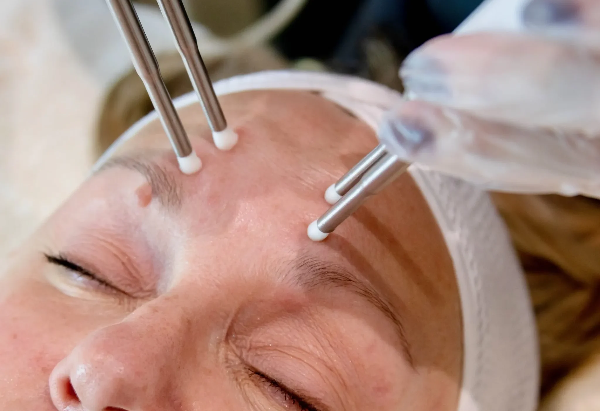 CACI