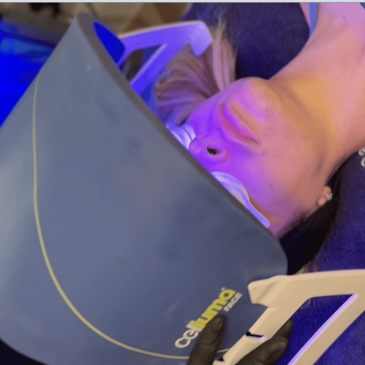 LED Light Therapy