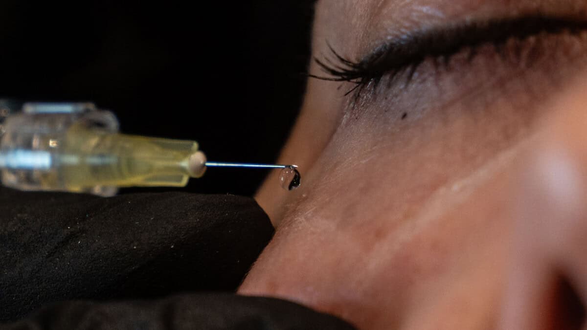 Under-eye filler