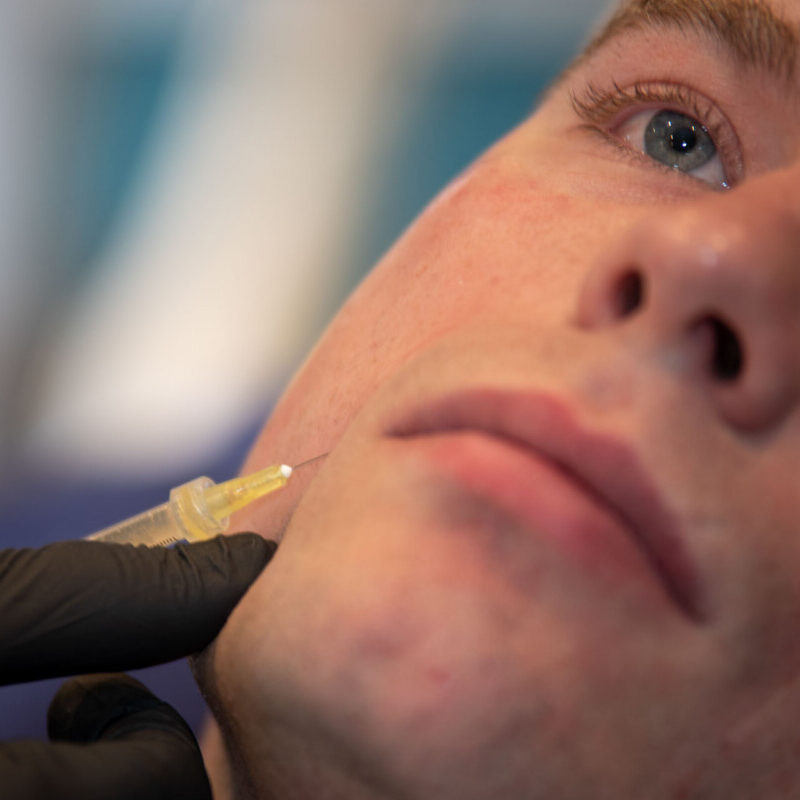 Chin & Jawline Filler