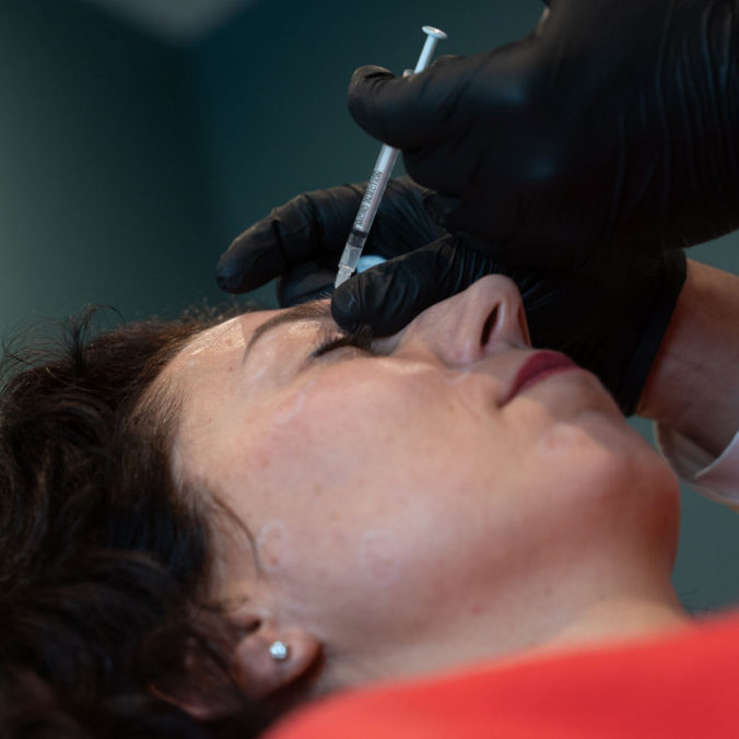 Nose Filler