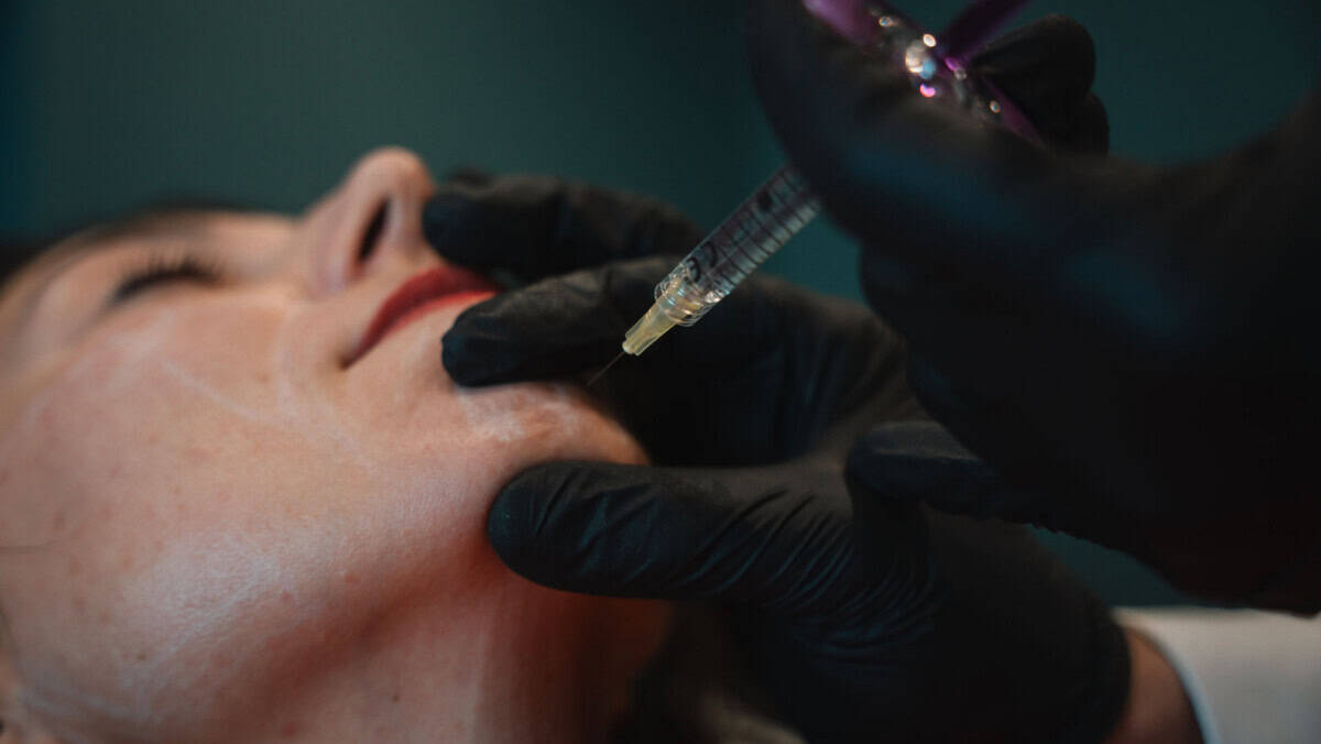 Dermal Fillers