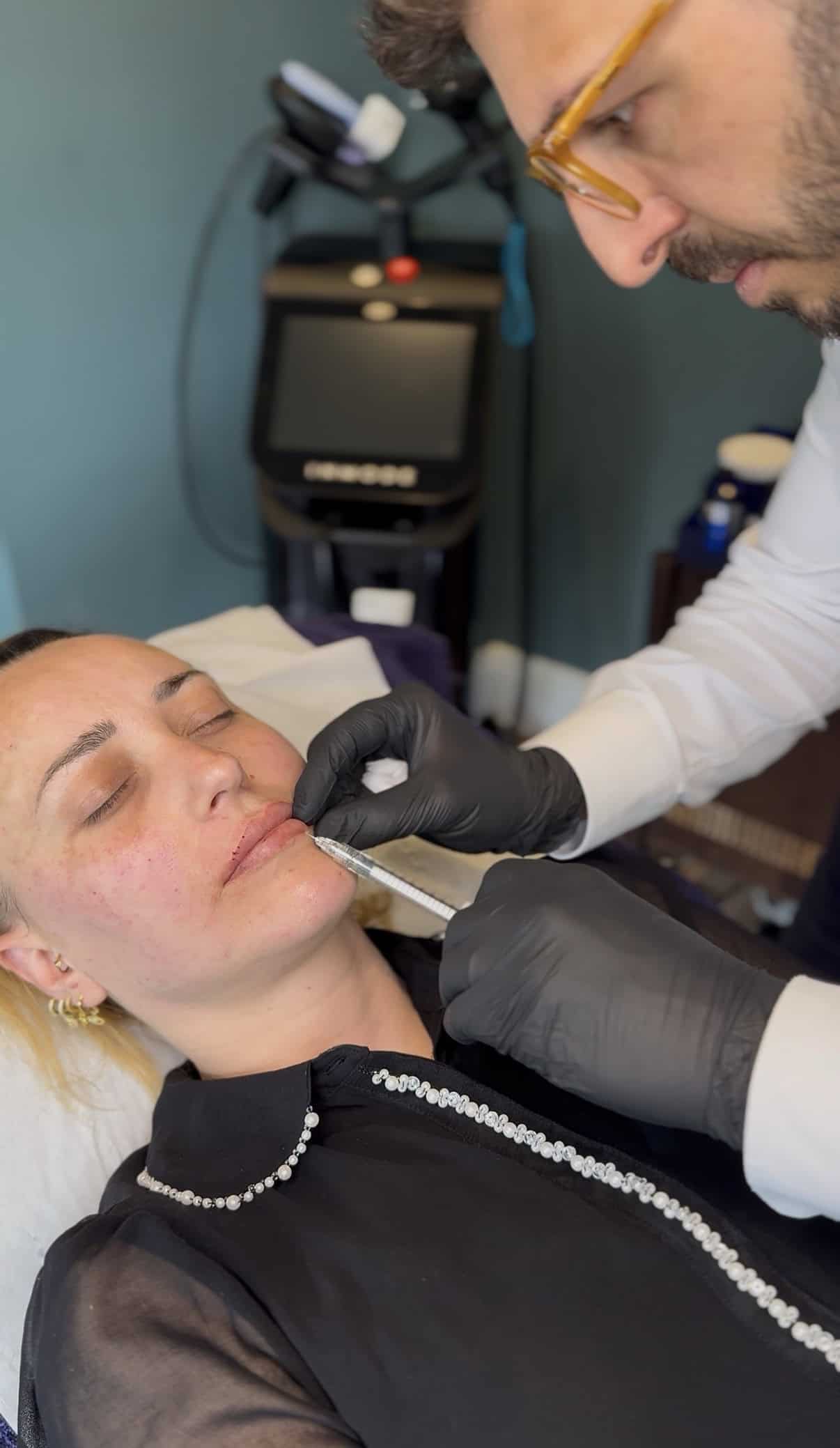 Lip filler