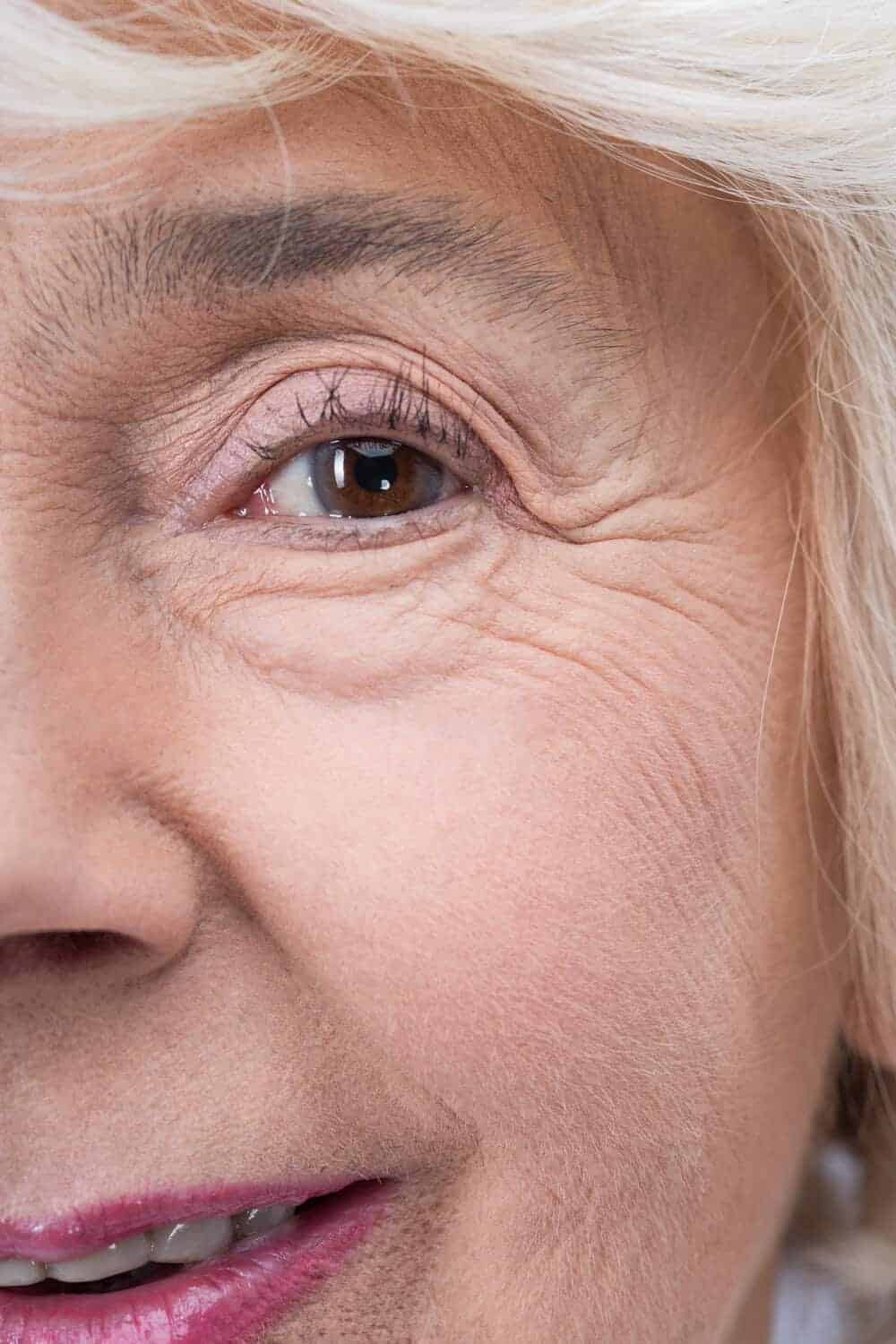 Close up of crepey, finely lined skin beneath the eye