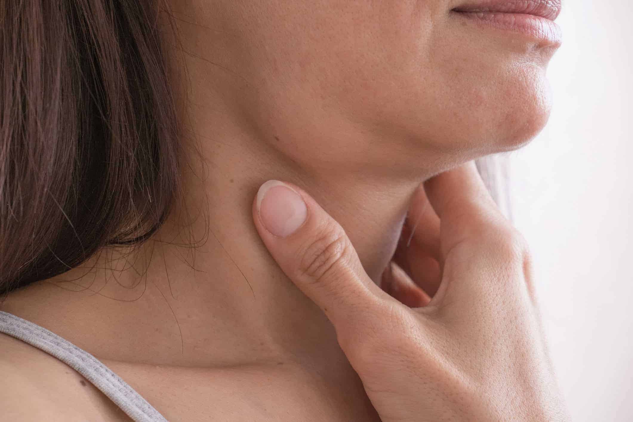 Fullness Under the Chin