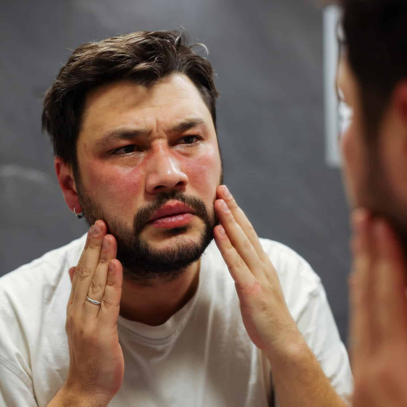 Skin That Stings at Skincare