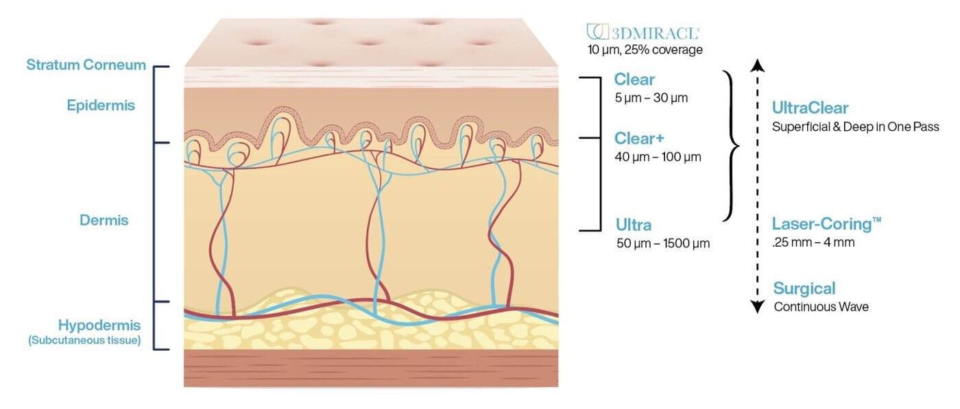 Diagram of UltraClear treatment depths: Clear and Clear+ in the epidermis, Ultra in the dermis, UltraClear superficial and deep in one pass, and Laser-Coring reaching deeper still